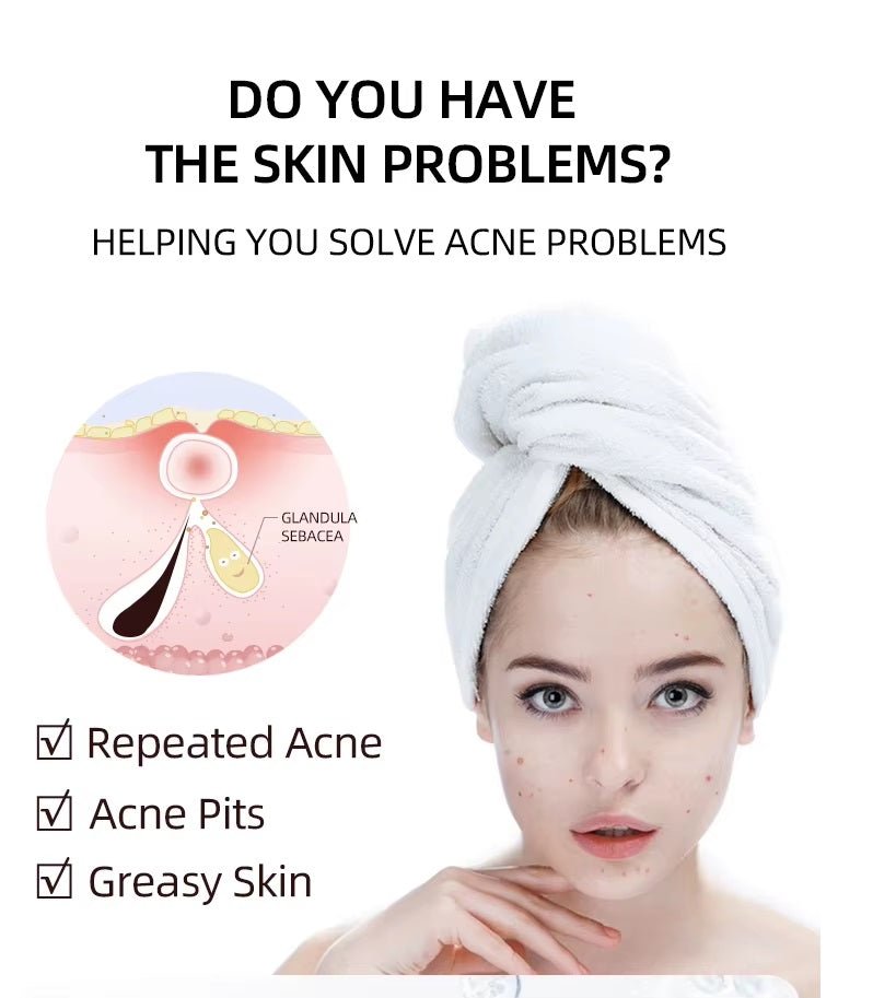 Acne Scar Anti Spots Removal Gel-Fast Effective Repair