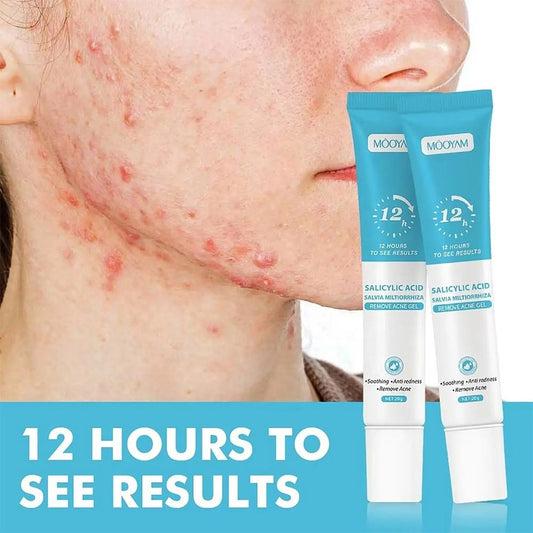Acne Scar Anti Spots Removal Gel-Fast Effective Repair