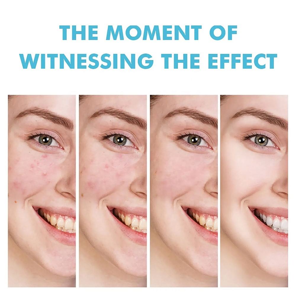Acne Scar Anti Spots Removal Gel-Fast Effective Repair